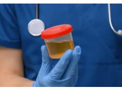 尿中有機酸的測定 氣相色譜-質(zhì)譜法 東西分析GC-MS 3250型
